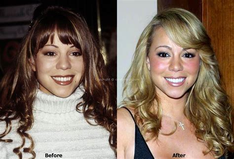 mariah carey boob job|Mariah Carey Before and After Plastic Surgery: Boob, Nose, Lips.